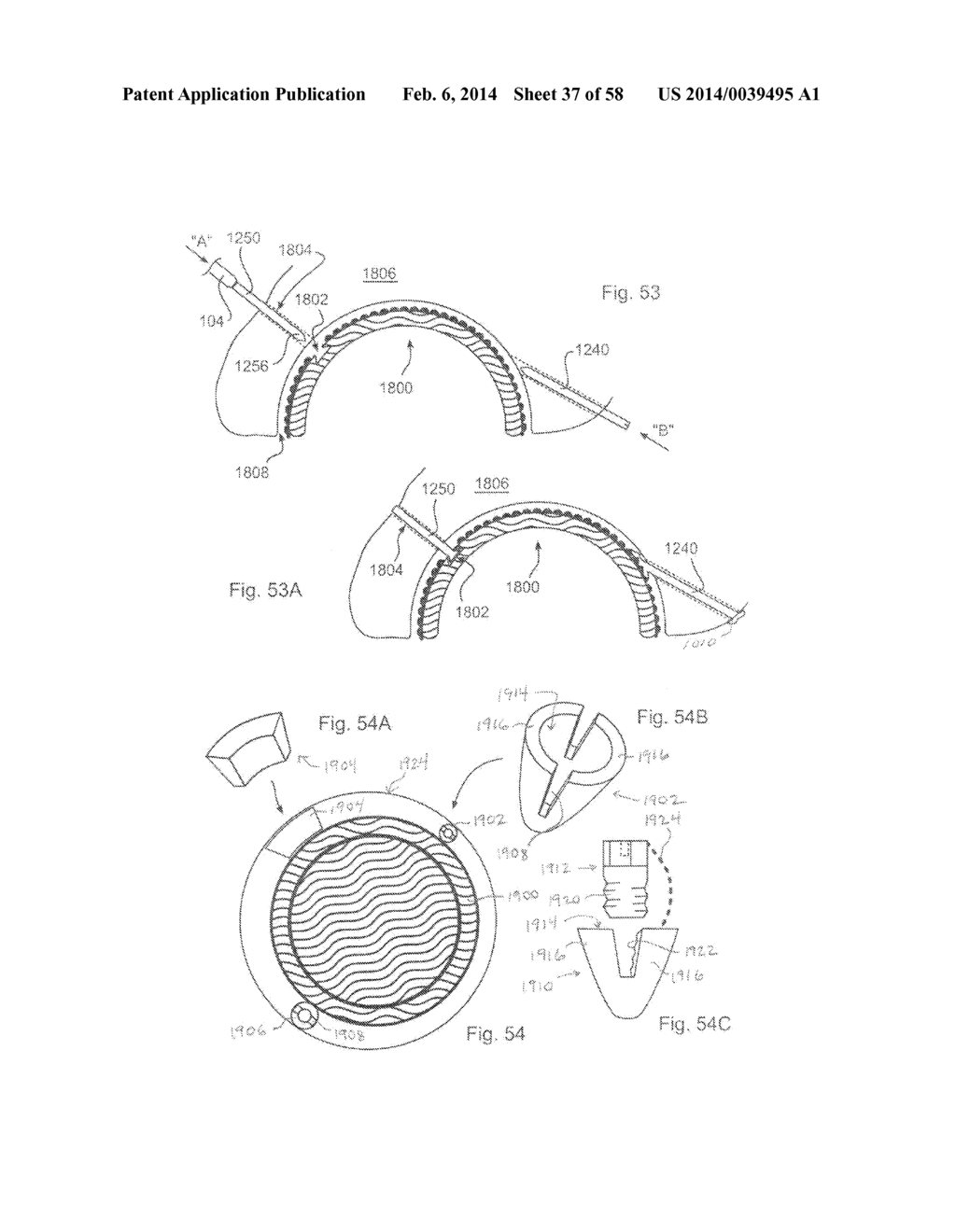 METHODS OF SECURING A FASTENER - diagram, schematic, and image 38