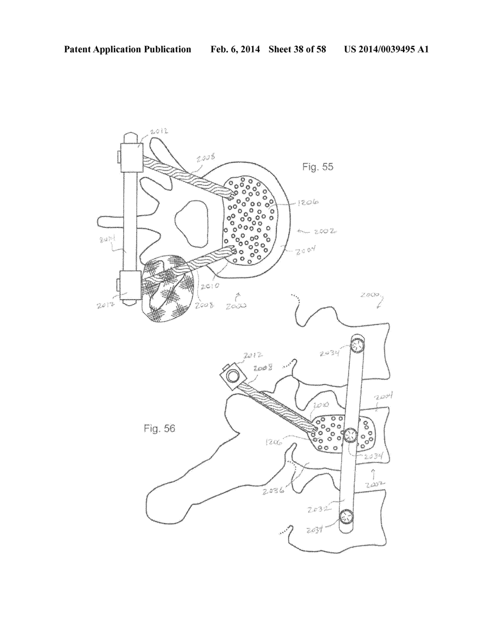 METHODS OF SECURING A FASTENER - diagram, schematic, and image 39