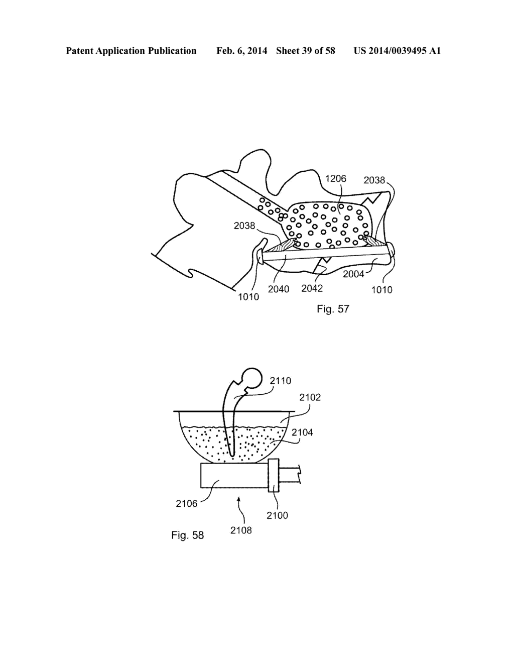 METHODS OF SECURING A FASTENER - diagram, schematic, and image 40