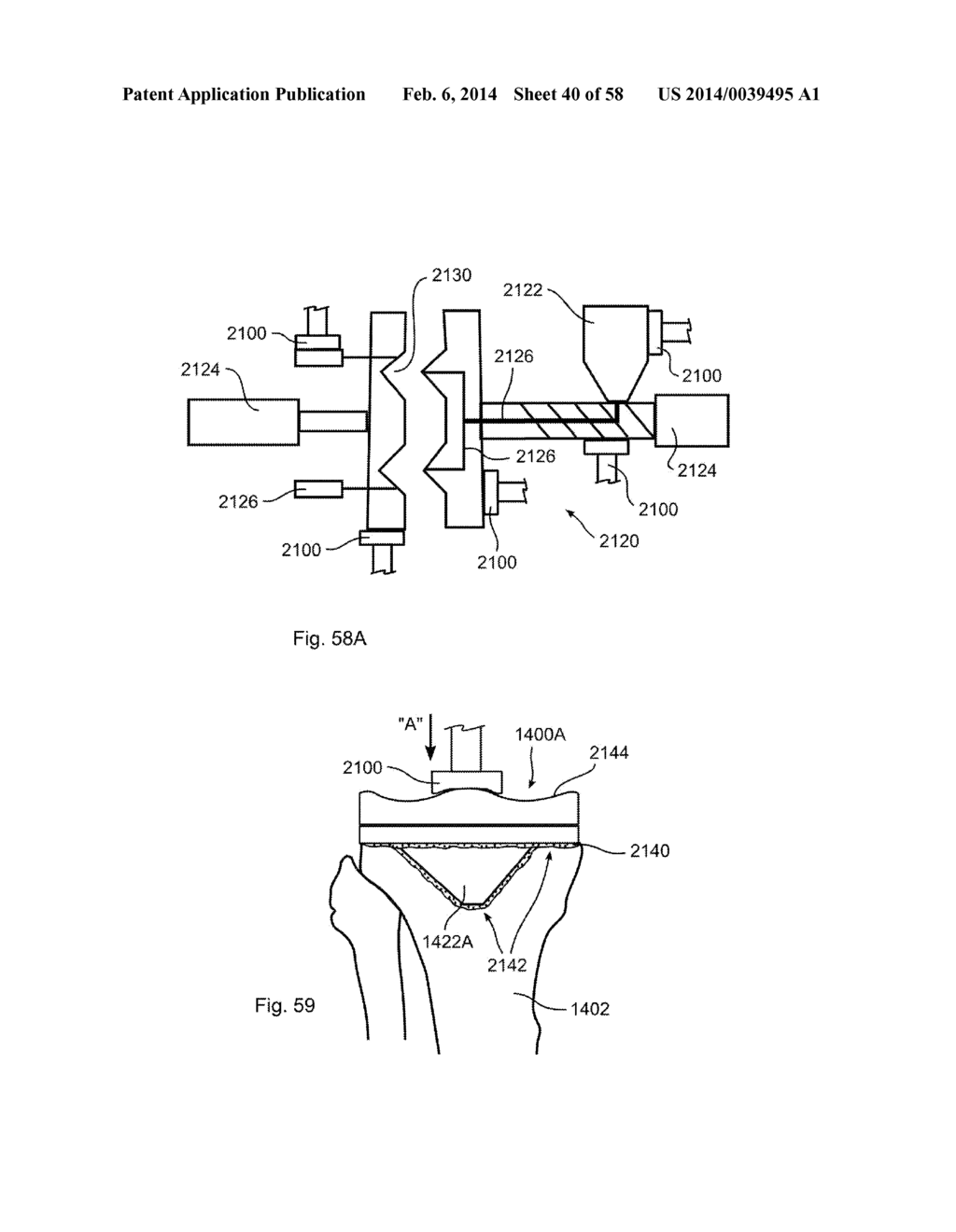 METHODS OF SECURING A FASTENER - diagram, schematic, and image 41