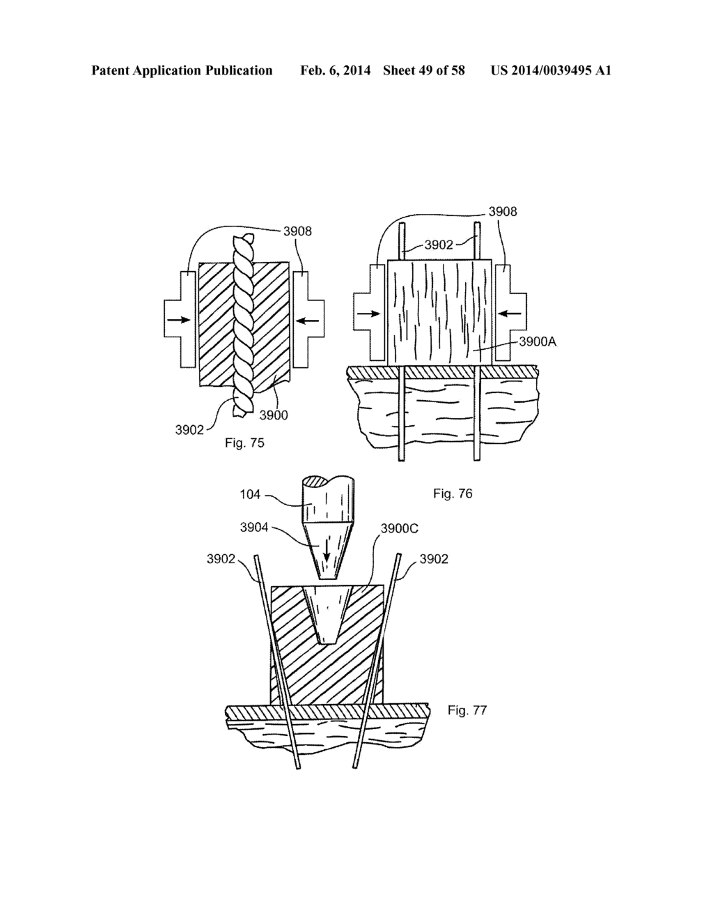 METHODS OF SECURING A FASTENER - diagram, schematic, and image 50