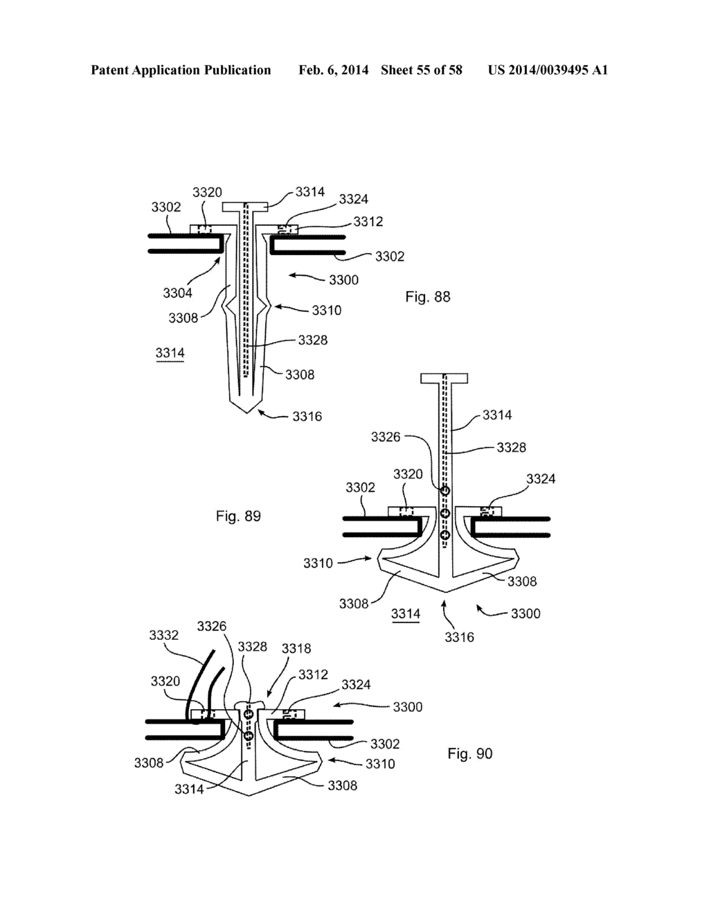 METHODS OF SECURING A FASTENER - diagram, schematic, and image 56