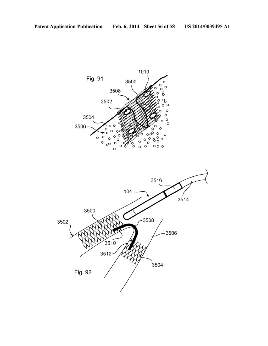 METHODS OF SECURING A FASTENER - diagram, schematic, and image 57