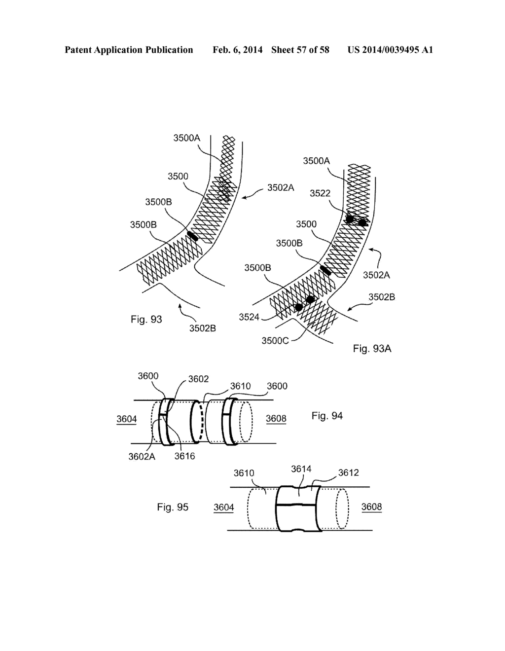 METHODS OF SECURING A FASTENER - diagram, schematic, and image 58