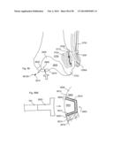 METHODS OF SECURING A FASTENER diagram and image