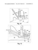 METHOD AND APPARATUS FOR PROVIDING A SOFT-TISSUE TRANSPLANT TO A RECEIVING     BONE diagram and image