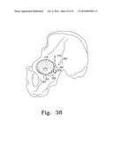 RECIPROCATING RASPS FOR USE IN AN ORTHOPAEDIC SURGICAL PROCEDURE diagram and image