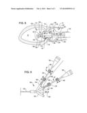 SHOCK WAVE VALVULOPLASTY DEVICE WITH MOVEABLE SHOCK WAVE GENERATOR diagram and image