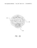 IMPLANTABLE MICROSTIMULATORS AND METHODS FOR UNIDIRECTIONAL PROPAGATION OF     ACTION POTENTIALS diagram and image