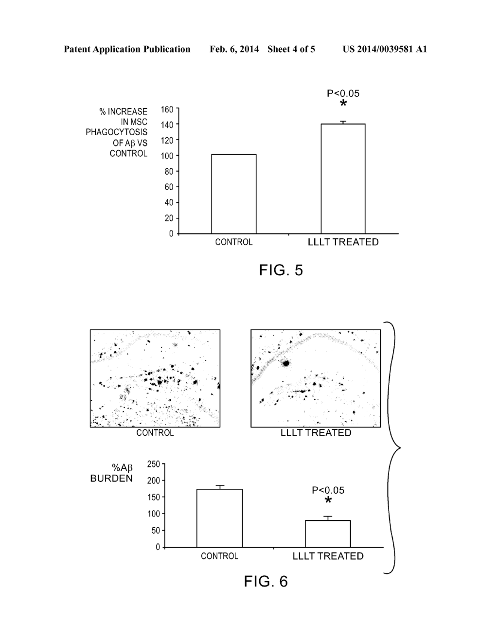 LOW LEVEL LASER THERAPY FOR ALZHEIMER'S DISEASE - diagram, schematic, and image 05