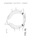 COLD THERAPY DEVICE WITH INDIVIDUAL COMPARTMENTS diagram and image