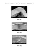 CRUSH RECOVERABLE POLYMER SCAFFOLDS diagram and image