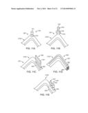 CRUSH RECOVERABLE POLYMER SCAFFOLDS diagram and image