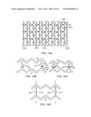 CRUSH RECOVERABLE POLYMER SCAFFOLDS diagram and image