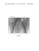 CRUSH RECOVERABLE POLYMER SCAFFOLDS diagram and image