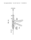 Stent-Valves For Valve Replacement and Associated Methods and Systems for     Surgery diagram and image