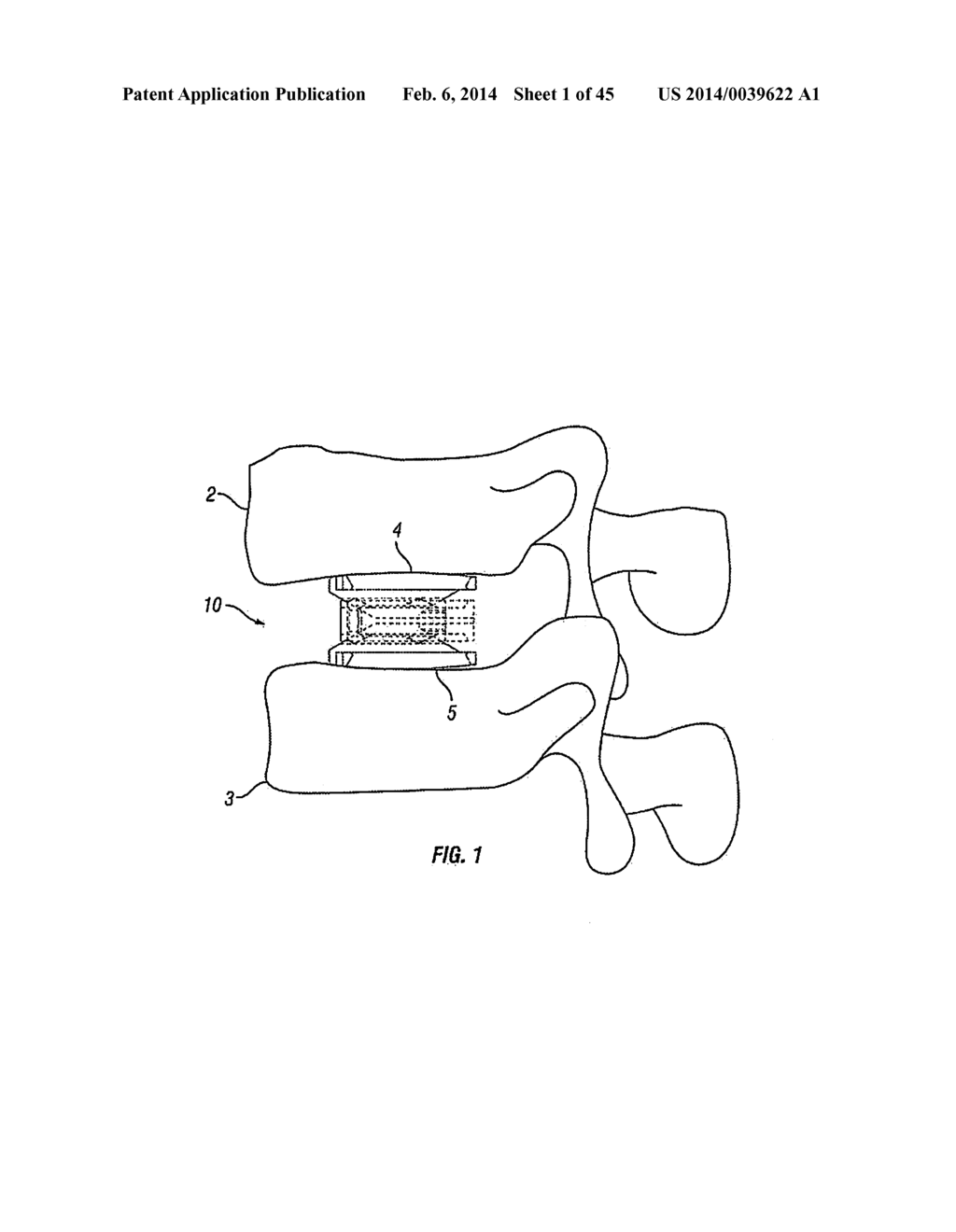 Expandable Fusion Device and Method of Installation Thereof - diagram, schematic, and image 02