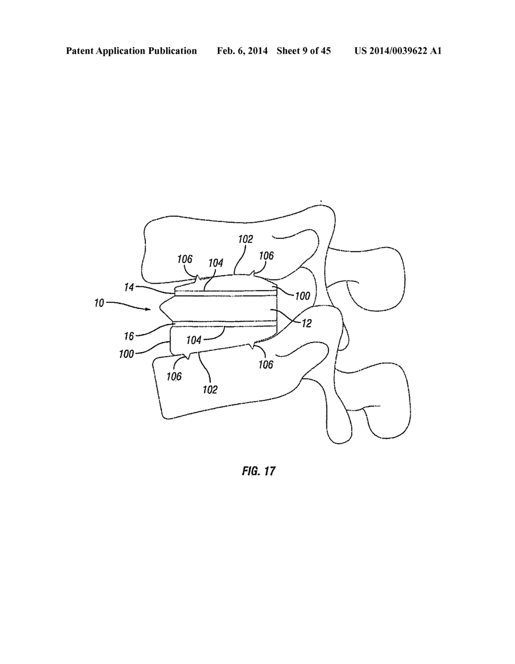 Expandable Fusion Device and Method of Installation Thereof - diagram, schematic, and image 10