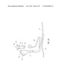 PROSTHETIC ANKLE MODULE diagram and image