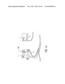 PROSTHETIC ANKLE MODULE diagram and image