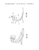 PROSTHETIC ANKLE MODULE diagram and image