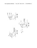 PROSTHETIC ANKLE MODULE diagram and image