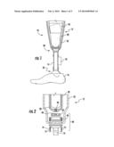 SYSTEMS AND METHODS FOR PROSTHETIC SUSPENSION SYSTEM diagram and image