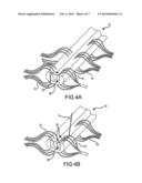 Animal Model of Central Neuropathic Pain and Methods of Making and Using     the Same diagram and image