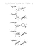 ANTIFOULING REMOVABLE STREAMER SECOND SKIN AND METHOD OF MOUNTING THEREOF diagram and image