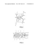 MEDICAL DEVICE FOR COMBATING OVERWEIGHT OR OBESITY IN HUMANS diagram and image