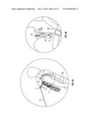 Rescue Descender System diagram and image