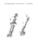 SURGICAL STAPLING INSTRUMENT diagram and image