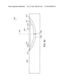 SURGICAL STAPLING INSTRUMENT diagram and image