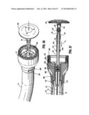 SURGICAL STAPLING DEVICE diagram and image