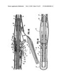 SURGICAL STAPLING DEVICE diagram and image