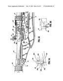 SURGICAL STAPLING DEVICE diagram and image