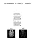 Interferometric Magnetic Resonance Imaging System and Related Method diagram and image