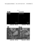 MICROVESICLES DERIVED FROM NUCLEATED, MAMMALIAN CELLS AND USE THEREOF diagram and image