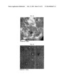 MICROVESICLES DERIVED FROM NUCLEATED, MAMMALIAN CELLS AND USE THEREOF diagram and image