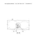 METHOD OF CREATING AN ACCURATE BONE AND SOFT-TISSUE DIGITAL DENTAL MODEL diagram and image