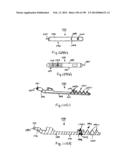 METHODS AND SYSTEMS FOR PERFORMING A MEDICAL PROCEDURE diagram and image