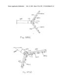 METHODS AND SYSTEMS FOR PERFORMING A MEDICAL PROCEDURE diagram and image