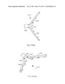 METHODS AND SYSTEMS FOR PERFORMING A MEDICAL PROCEDURE diagram and image