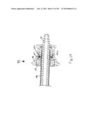 METHODS AND SYSTEMS FOR PERFORMING A MEDICAL PROCEDURE diagram and image