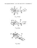 METHODS AND SYSTEMS FOR PERFORMING A MEDICAL PROCEDURE diagram and image