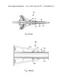 METHODS AND SYSTEMS FOR PERFORMING A MEDICAL PROCEDURE diagram and image