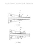 METHODS AND SYSTEMS FOR PERFORMING A MEDICAL PROCEDURE diagram and image