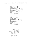 METHODS AND SYSTEMS FOR PERFORMING A MEDICAL PROCEDURE diagram and image