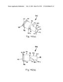 METHODS AND SYSTEMS FOR PERFORMING A MEDICAL PROCEDURE diagram and image