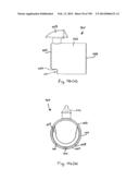 METHODS AND SYSTEMS FOR PERFORMING A MEDICAL PROCEDURE diagram and image